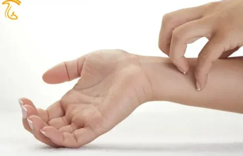قارچ و آلرژی یا حساسیت پوستی یکی از انواع شایع آلرژی ها است