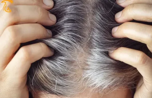 چه غذاهایی باعث تبدیل مو سفید به سیاه می شوند؟