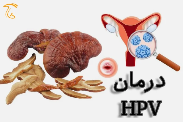 خواص گانودرما در درمان زگیل تناسلی