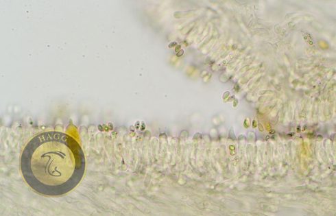 cystidium