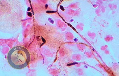 chlamydospores