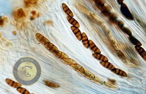 ascospores