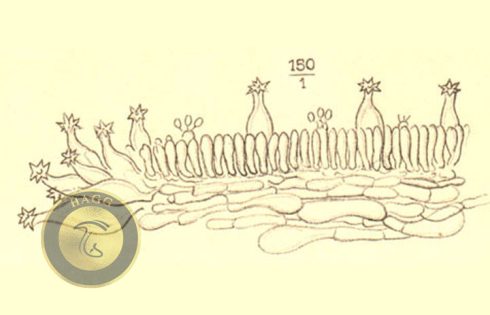 cheilocystidium