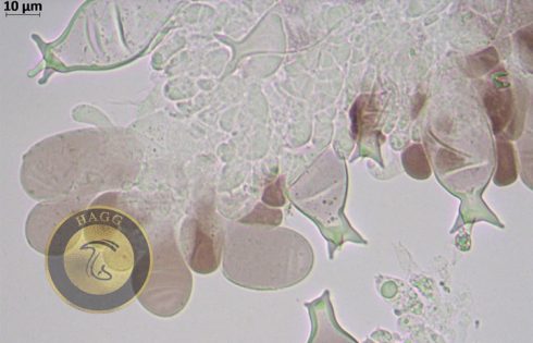 cheilocystidium