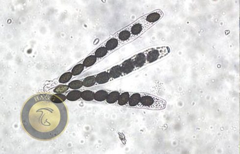 ascospores mushroom